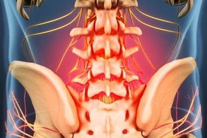 причины и симптомы остеохондроза